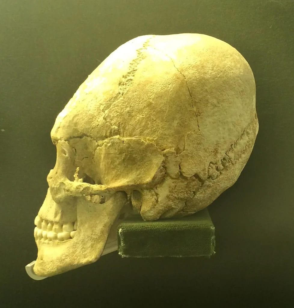 Deformed skull from a fifth-century burial in the Budapest History Museum, showing pronounced fronto-occipital shaping.